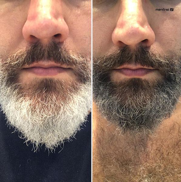 Gradual Men Barba (2x) - Escurecimento de Barba Branca - Total 6 Produtos  - MenFirst